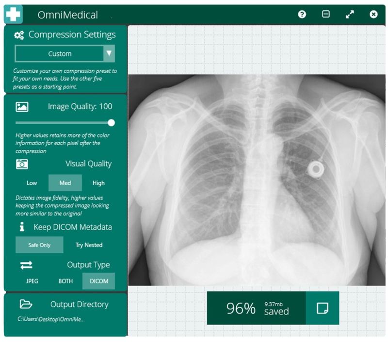 The OmniMEDICAL window previewing a chest x-ray with 96% saved